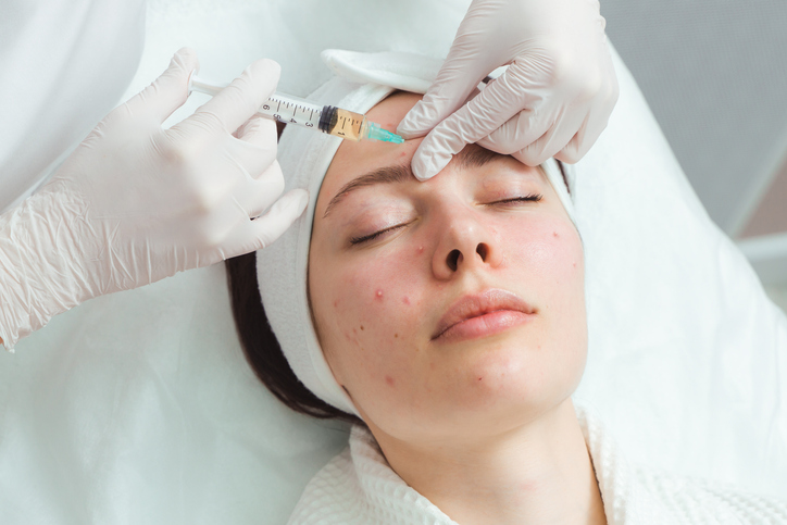 A young woman in a cosmetology clinic, undergoing acne treatment with injections. An effective remedy for acne